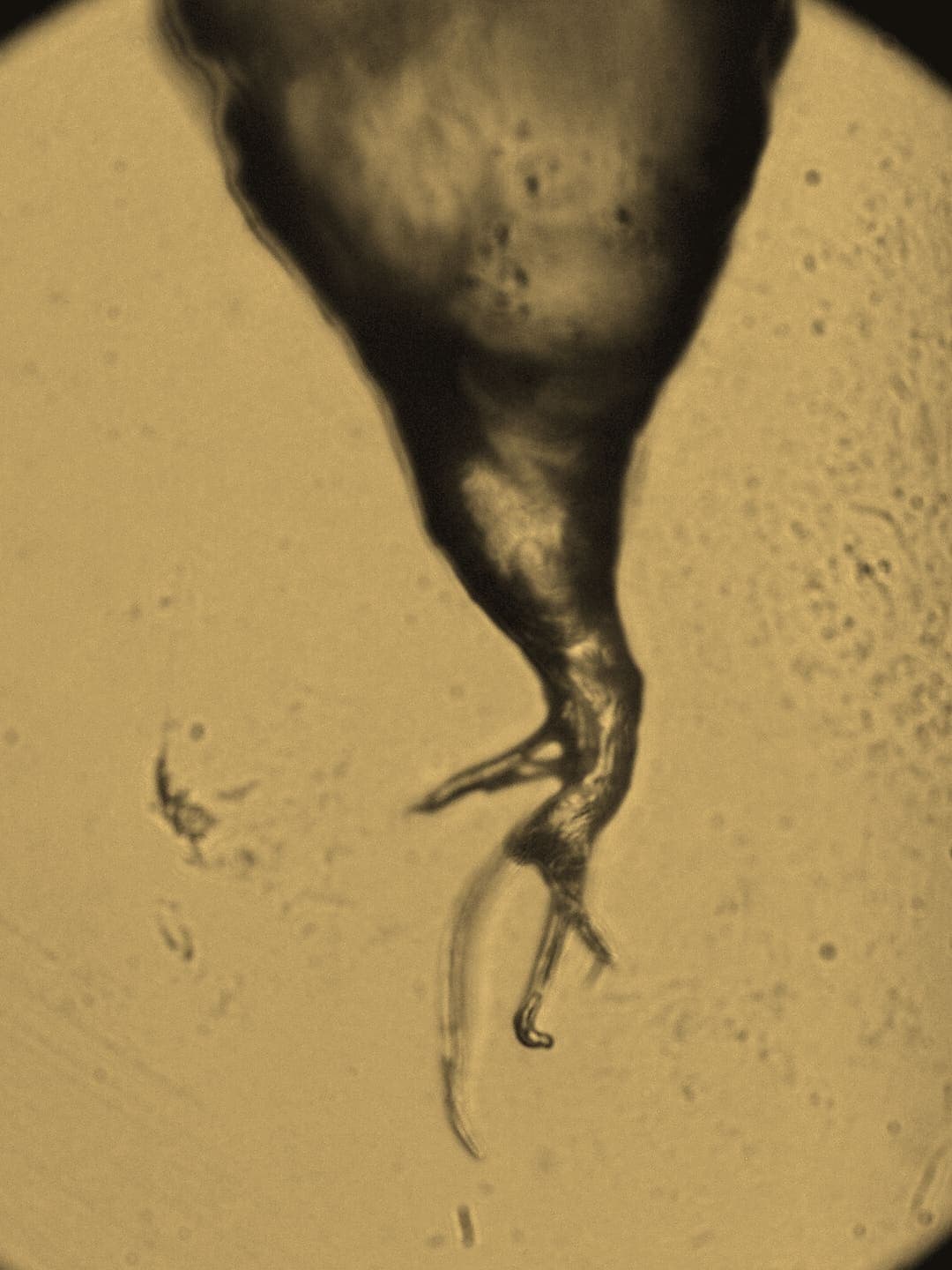 A hair root under a light microscope